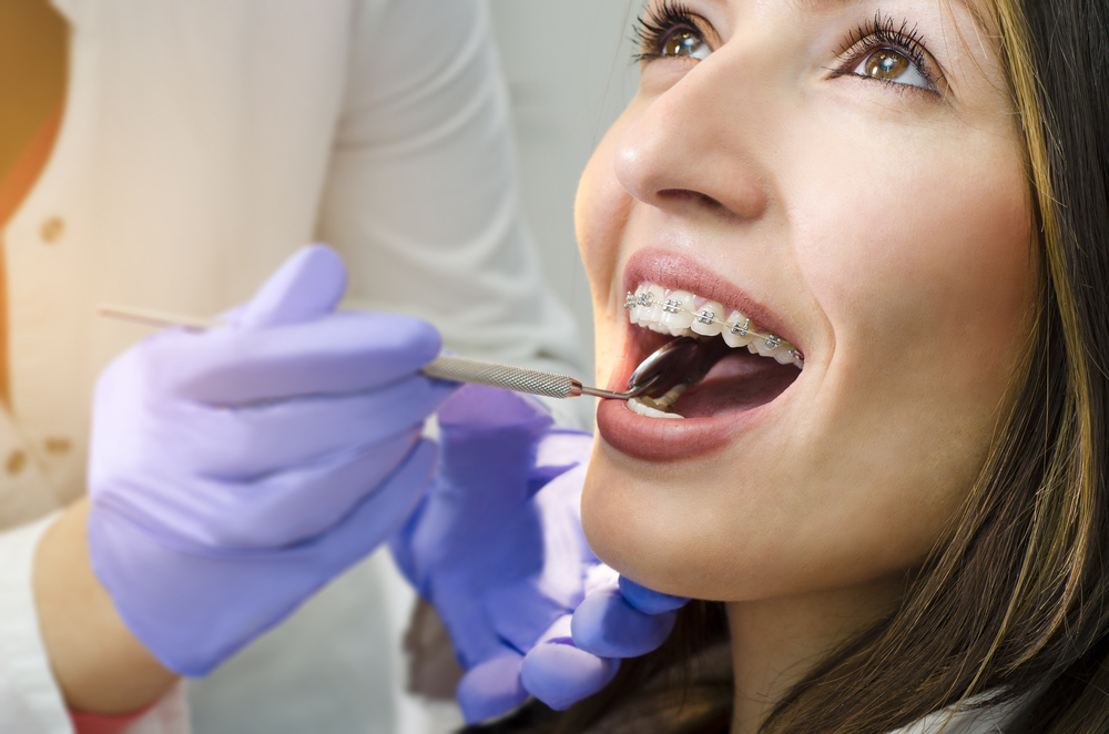 ceramic braces Periodontal Gum Disease